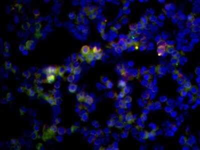 Immunocytochemistry/ Immunofluorescence: Polyoma Virus, Medium T Antigen Antibody (PyMT) - Azide and BSA Free [NBP2-80918]