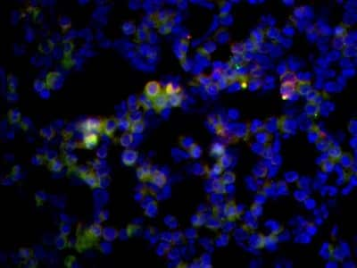 Immunocytochemistry/ Immunofluorescence: Polyoma Virus, Medium T Antigen Antibody (PyMT) [NB100-2749]