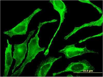 Immunocytochemistry/ Immunofluorescence: Polypeptide GalNac Transferase 1/GALNT1 Antibody (3C10) [H00002589-M10]