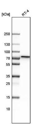 Western Blot: Polypeptide GalNac Transferase 1/GALNT1 Antibody [NBP1-81852]