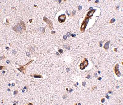 Immunohistochemistry-Paraffin: Polypeptide GalNac Transferase 10/GALNT10 Antibody - BSA Free [NBP1-77058]