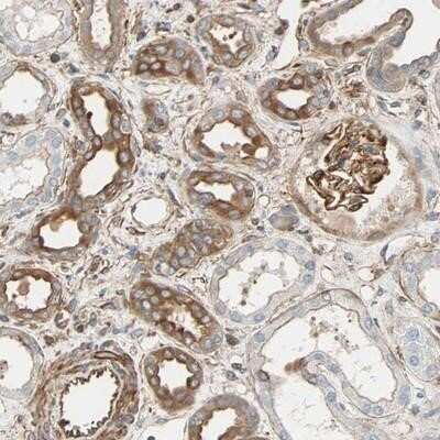 Immunohistochemistry-Paraffin: Polypeptide GalNac Transferase 10/GALNT10 Antibody [NBP1-85069]