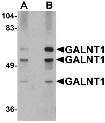 Western Blot: Polypeptide GalNac Transferase 10/GALNT10 AntibodyBSA Free [NBP1-77059]