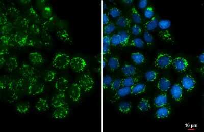 Immunocytochemistry/ Immunofluorescence: Polypeptide GalNac Transferase 3/GALNT3 Antibody [NBP3-13034]