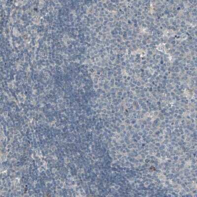 Immunohistochemistry-Paraffin: Polypeptide GalNac Transferase 3/GALNT3 Antibody [NBP1-81849]