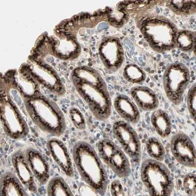 Immunohistochemistry-Paraffin: Polypeptide GalNac Transferase 3/GALNT3 Antibody [NBP1-81849]