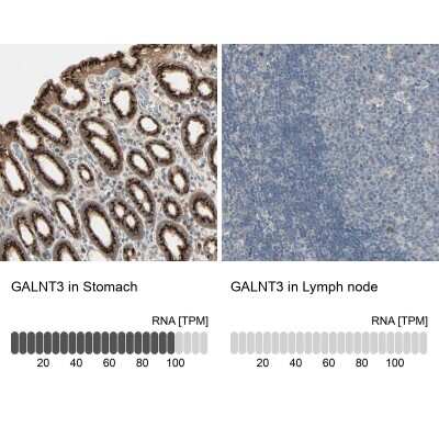 Immunohistochemistry-Paraffin: Polypeptide GalNac Transferase 3/GALNT3 Antibody [NBP1-81849]