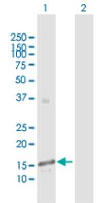 Western Blot: Polypeptide GalNac Transferase 3/GALNT3 Antibody [H00002591-D01P]