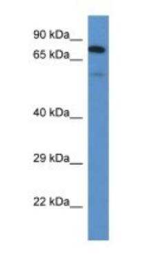 Western Blot: Polypeptide GalNac Transferase 3/GALNT3 Antibody [NBP1-74244]