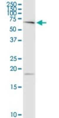 Western Blot: Polypeptide GalNac Transferase 4/GALNT4 Antibody [H00008693-D01P]