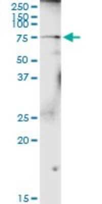 Western Blot: Polypeptide GalNac Transferase 4/GALNT4 Antibody [H00008693-D01P]
