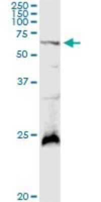 Western Blot: Polypeptide GalNac Transferase 4/GALNT4 Antibody [H00008693-D01P]