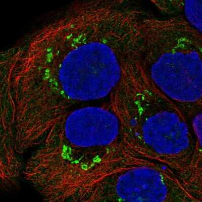Immunocytochemistry/ Immunofluorescence: Polypeptide GalNac Transferase 7/GALNT7 Antibody [NBP2-39021]