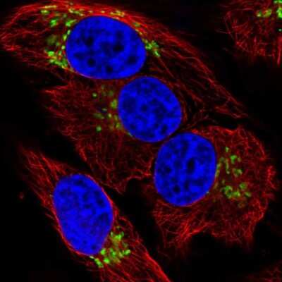 Immunocytochemistry/ Immunofluorescence: Polypeptide GalNac Transferase 7/GALNT7 Antibody [NBP2-39054]