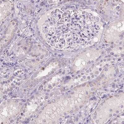 Immunohistochemistry-Paraffin: Polypeptide GalNac Transferase 7/GALNT7 Antibody [NBP2-39021]