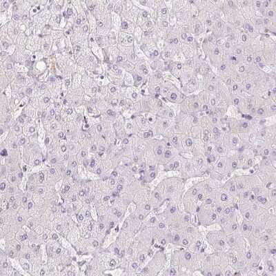 Immunohistochemistry-Paraffin: Polypeptide GalNac Transferase 7/GALNT7 Antibody [NBP2-39021]