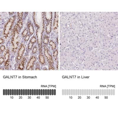 Immunohistochemistry-Paraffin: Polypeptide GalNac Transferase 7/GALNT7 Antibody [NBP2-39021]