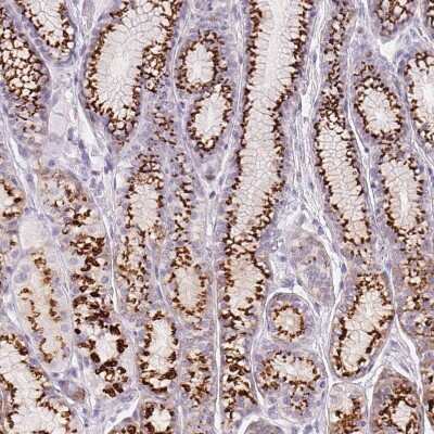 Immunohistochemistry-Paraffin: Polypeptide GalNac Transferase 7/GALNT7 Antibody [NBP2-39054]