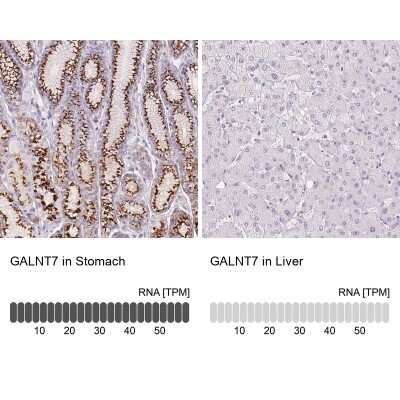 Immunohistochemistry-Paraffin: Polypeptide GalNac Transferase 7/GALNT7 Antibody [NBP2-39054]