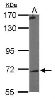 Western Blot: Polypeptide GalNac Transferase 7/GALNT7 Antibody [NBP1-32491]