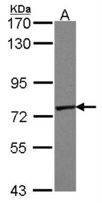 Western Blot: Polypeptide GalNac Transferase 7/GALNT7 Antibody [NBP1-32491]