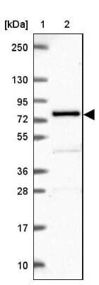 Western Blot: Polypeptide GalNac Transferase 7/GALNT7 Antibody [NBP2-39021]