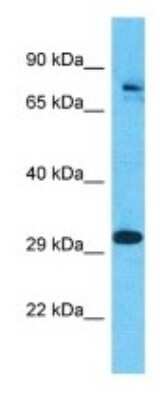 Western Blot: Polypeptide GalNac Transferase 7/GALNT7 Antibody [NBP3-09941]