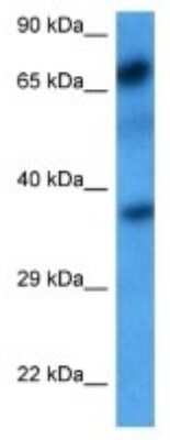 Western Blot: Polypeptide GalNac Transferase 7/GALNT7 Antibody [NBP3-10009]