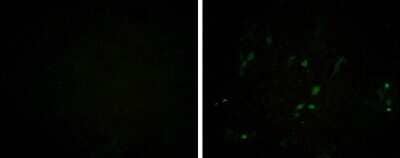 Immunocytochemistry/ Immunofluorescence: Porcine Circovirus 2 Capsid Antibody (GT972) [NBP3-13604]