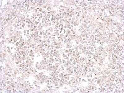 Immunohistochemistry-Paraffin: Porcine Circovirus 2 Capsid Antibody [NBP3-12878]