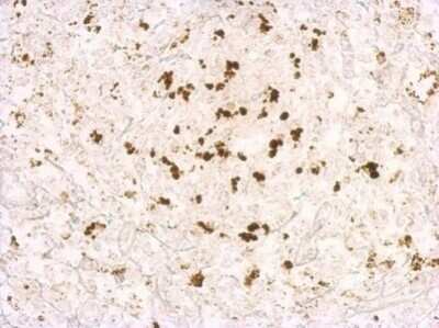 Immunohistochemistry-Paraffin: Porcine Circovirus 2 Capsid Antibody [NBP3-12878]