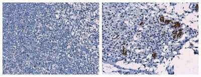Immunohistochemistry-Paraffin: Porcine Circovirus 2 Capsid Antibody [NBP3-12878]