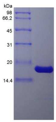 SDS-PAGE: Recombinant Porcine IL-1 beta/IL-1F2 Protein [NBP2-35228]