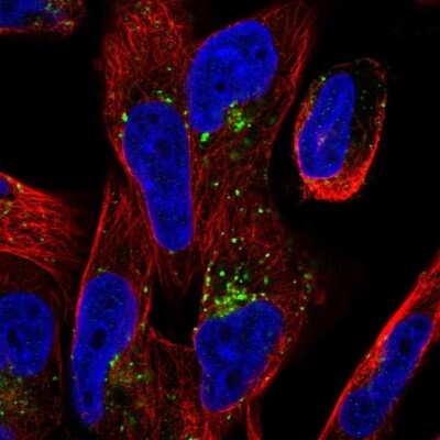 Immunocytochemistry/ Immunofluorescence: Porimin Antibody [NBP2-68797]