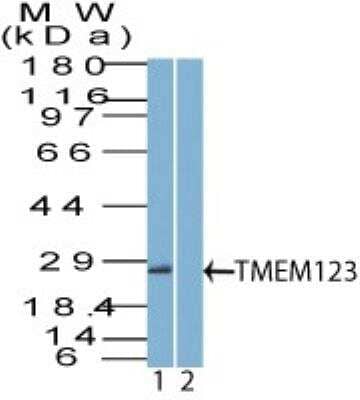 Western Blot: Porimin Antibody [NBP2-27172]