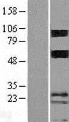 Western Blot: Porimin Overexpression Lysate [NBP2-05840]