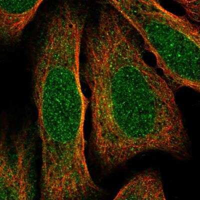 Immunocytochemistry/ Immunofluorescence: Potassium Channel Kv3.1 Antibody [NBP2-30395]