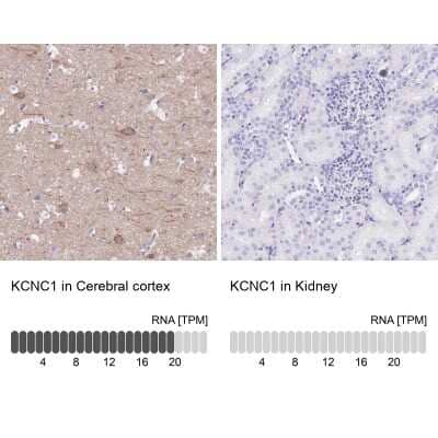 Immunohistochemistry-Paraffin: Potassium Channel Kv3.1 Antibody [NBP2-30395]