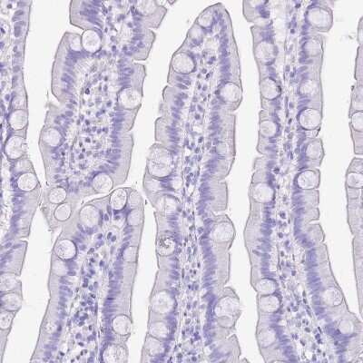 Immunohistochemistry-Paraffin: Potassium Channel Kv3.1 Antibody [NBP2-30395]