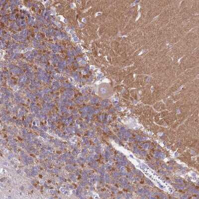 Immunohistochemistry-Paraffin: Potassium Channel Kv3.1 Antibody [NBP2-30395]