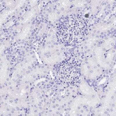 Immunohistochemistry-Paraffin: Potassium Channel Kv3.1 Antibody [NBP2-30395]