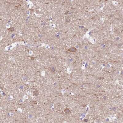 Immunohistochemistry-Paraffin: Potassium Channel Kv3.1 Antibody [NBP2-30395]