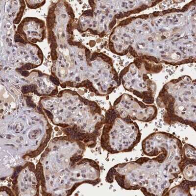 Immunohistochemistry-Paraffin: Potassium channel subfamily K member 6 Antibody [NBP2-34063]