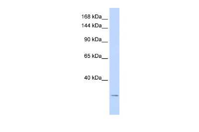 Western Blot: Potassium channel subfamily K member 6 Antibody [NBP2-83408]