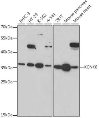 Western Blot: Potassium channel subfamily K member 6 AntibodyAzide and BSA Free [NBP2-93795]