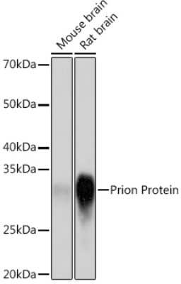 Western Blot: PrPC Antibody (3D0J9) [NBP3-16708]