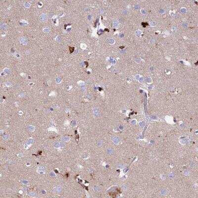 Immunohistochemistry-Paraffin: PrPC Antibody [NBP2-38508]