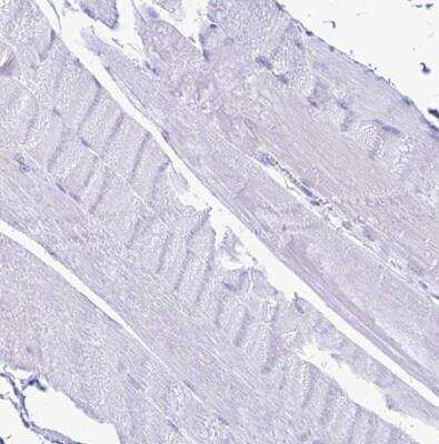 Immunohistochemistry-Paraffin: PrPC Antibody [NBP2-38508]