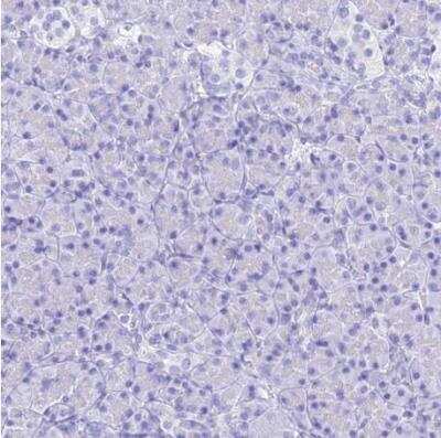Immunohistochemistry-Paraffin: PrPC Antibody [NBP2-38508]