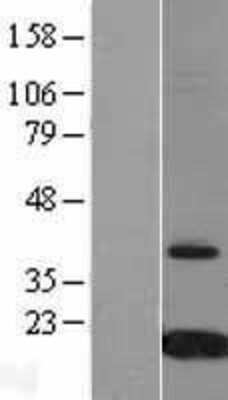 Western Blot: Transthyretin/Prealbumin Overexpression Lysate [NBL1-17423]